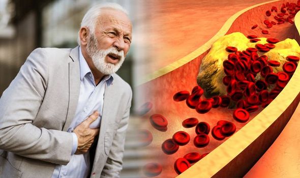 CHOLESTROL IN OLDER ADULTS